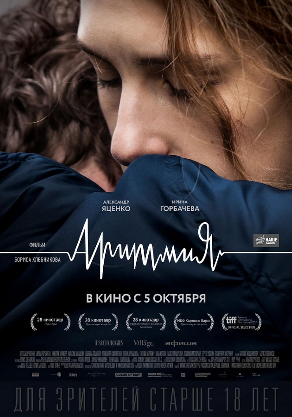 Arrhythmia 