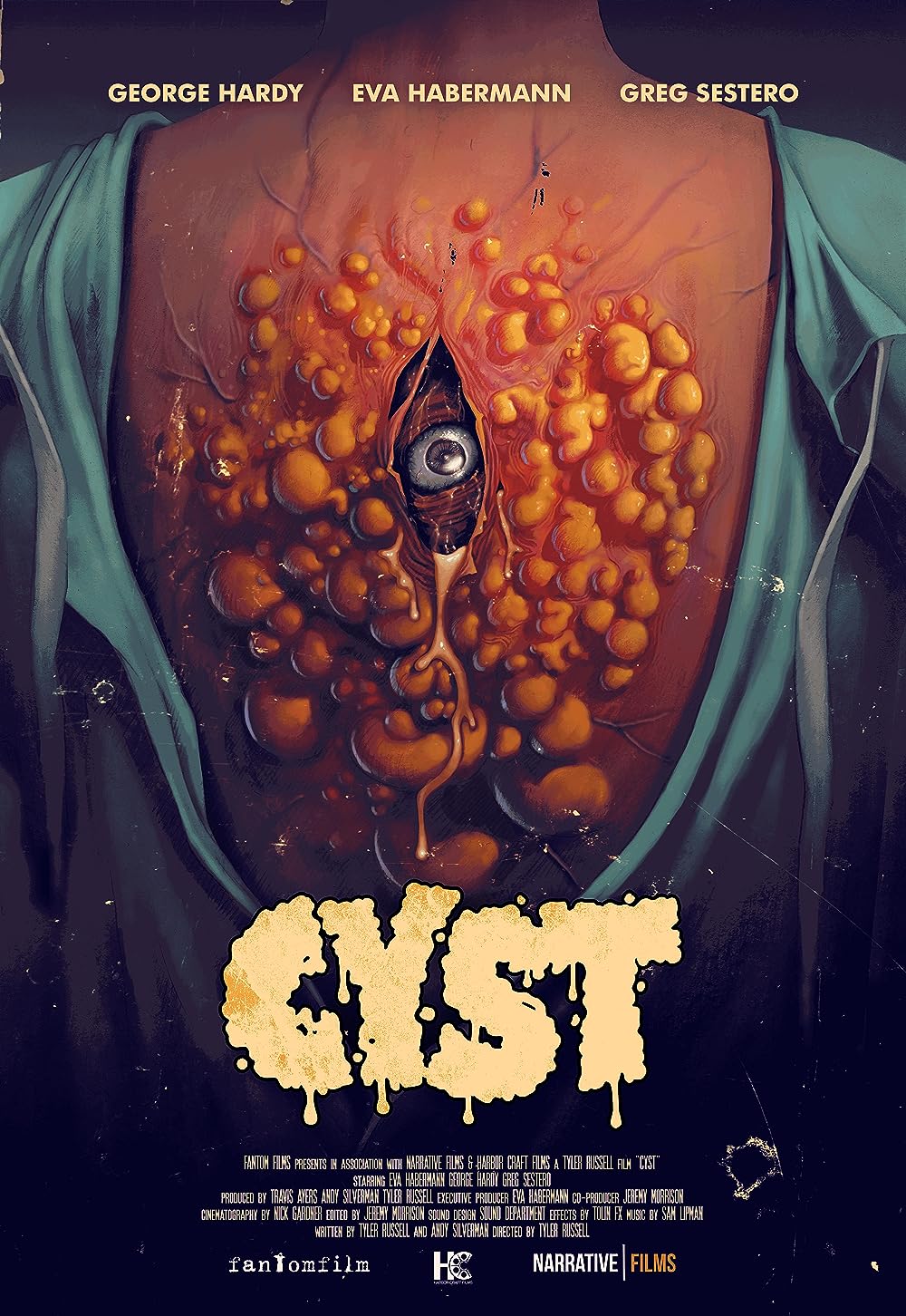Cyst 
