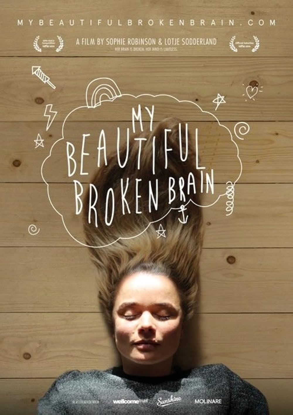 My Beautiful Broken Brain 