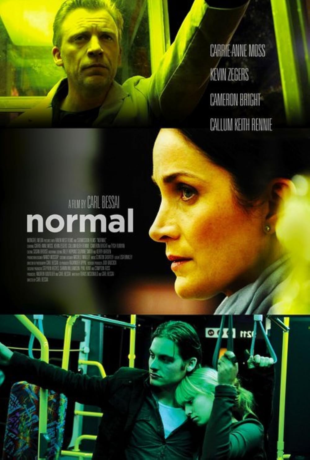 Normal 