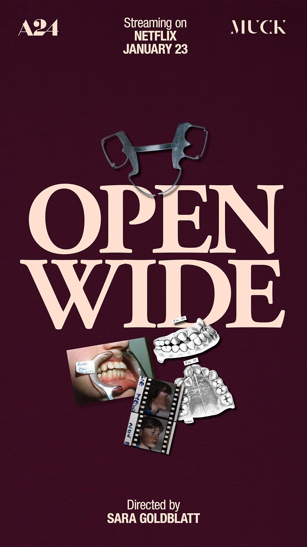 Open Wide 