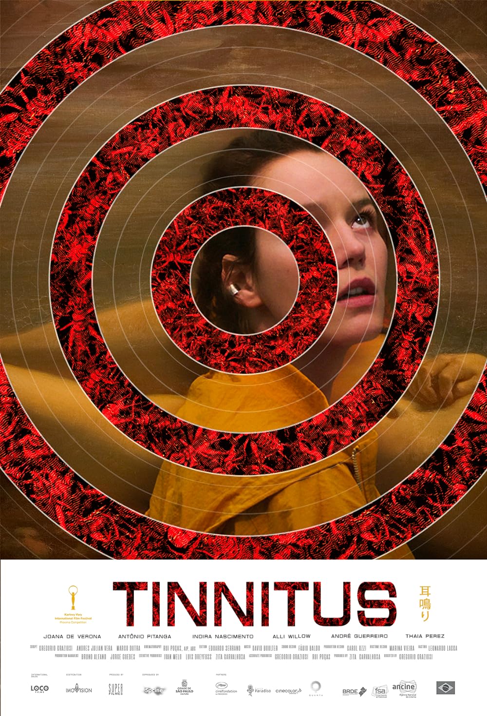 Tinnitus 
