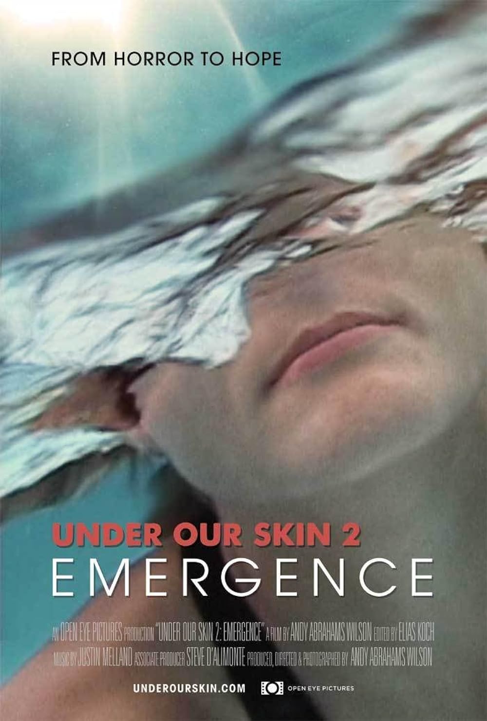 Under Our Skin 2: Emergence 